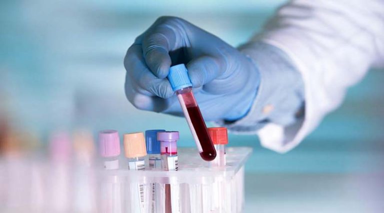 Νέο τεστ αίματος ανιχνεύει 18 μορφές καρκίνου σε πρώιμο στάδιο!