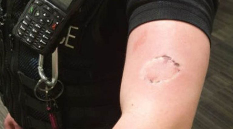 Κορονοϊός: Άνδρας δάγκωσε και χτύπησε αστυνομικούς που τον σταμάτησαν για έλεγχο! (φωτό)