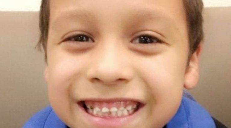Φρίκη: Μητριά βασάνισε μέχρι θανάτου 9χρονο – Τον βρήκαν γεμάτο μελανιές (φωτό)