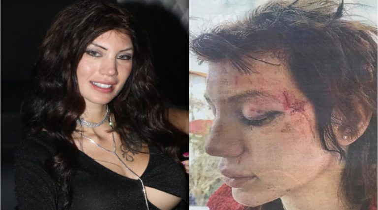 Εφιάλτης για την Μαρία Αλεξάνδρου! 6 γυναίκες την απήγαγαν, την χτύπησαν και την κούρεψαν (φωτό)