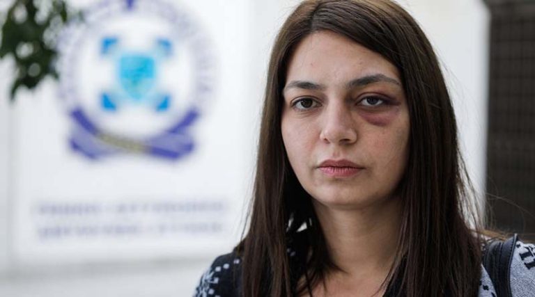 Στη ΓΑΔΑ η βουλευτής Αν. Αττικής Μαρία Απατζίδη – Ζήτησε εξηγήσεις για το χτύπημα που δέχθηκε από αστυνομικό
