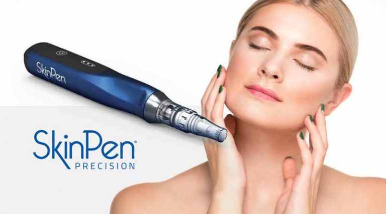Σοφία Μασούρη: Θεραπεία skin pen για ουλές ακμής και λεπτές ρυτίδες