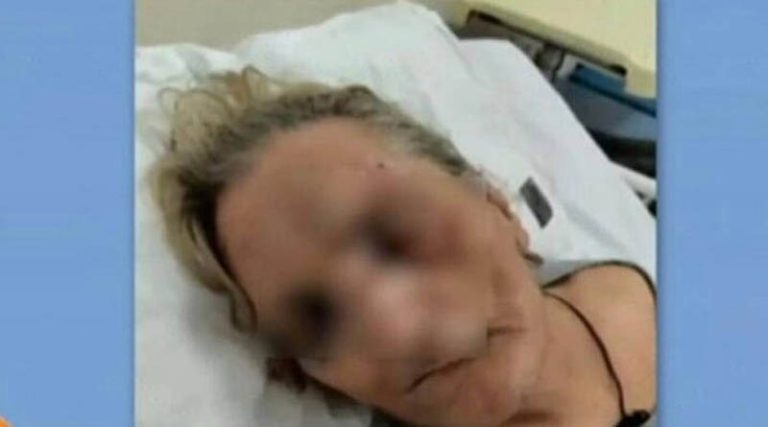 Αποκλειστική νοσοκόμα ξυλοκόπησε ηλικιωμένη – Συγκλονίζουν οι εικόνες – Τι λέει η κόρη της