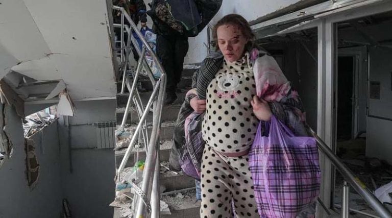 Πόλεμος στην Ουκρανία: Νέες φωτογραφίες από την τραυματισμένη γυναίκα που γέννησε στη Μαριούπολη και έλεγαν ότι ήταν «ηθοποιός»