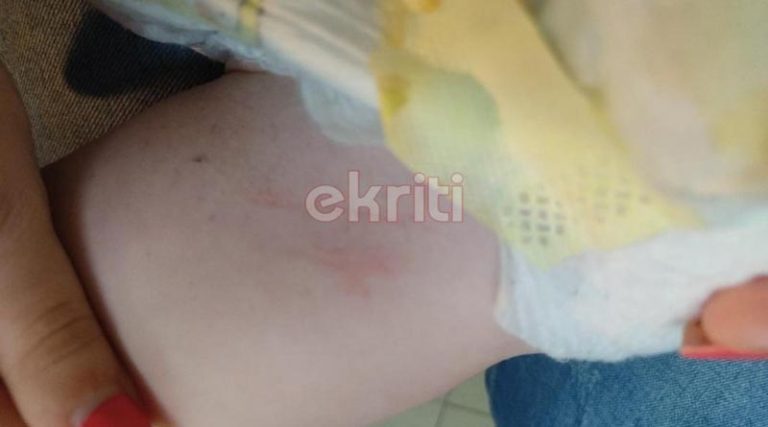 Σοκαριστικές εικόνες από την επίθεση του σκύλου σε μωρό που ήταν στην αγκαλιά της γιαγιάς του