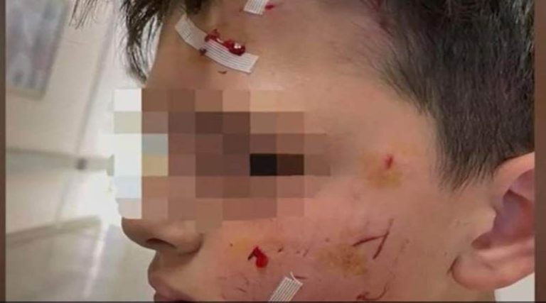 Ο Δήμαρχος Σαρωνικού Π. Φιλίππου για την επίθεση σκύλου σε 14χρονο στο Λαγονήσι (βίντεο)