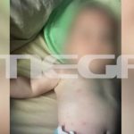 Γεμάτο με τσιμπήματα από ψύλλους το μωρό που δολοφονήθηκε από τον πατέρα του (φωτό & βίντεο)