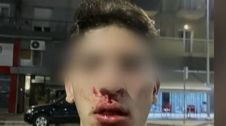 Τρομακτικό περιστατικό! Ομάδα 10 ατόμων ξυλοκόπησε 20χρονο και την κοπέλα του! (βίντεο)