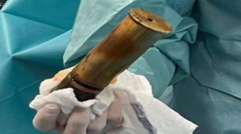 Μία οβίδα στον… πρωκτό 88χρονου οδήγησε σε εκκένωση ολόκληρου νοσοκομείου