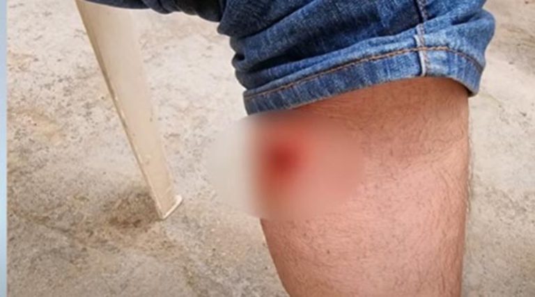 Μενίδι: Χτυπήθηκε από αδέσποτη σφαίρα την ώρα του πασχαλινού τραπεζιού! (βίντεο)