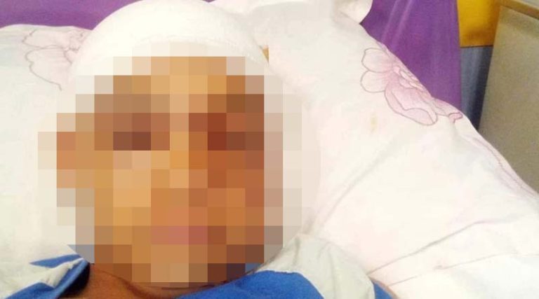 Αρτέμιδα: Χειρουργήθηκε στο κρανίο ο 11χρονος που τον δάγκωσε πιτ μπουλ