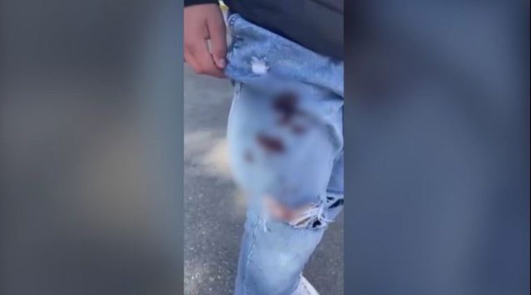 Σοκ! 14χρονος μαχαίρωσε συμμαθητή του με σουγιά