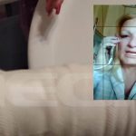 Ραφήνα: Σοκάρουν οι εικόνες από την γυναίκα που της επιτέθηκαν σκυλιά στην Μάντικα! (φωτό & βίντεο)